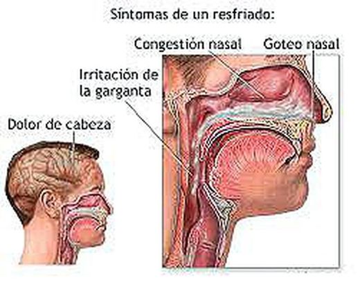 Combate resfriados y gripes tomando Bronocho y Bronocho Plus de Conatal. Alivia los sintomas desde la primera toma.
