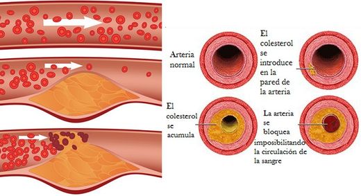 Combate el colesterol de forma natural LEVADURA ROJA DE ARROZ