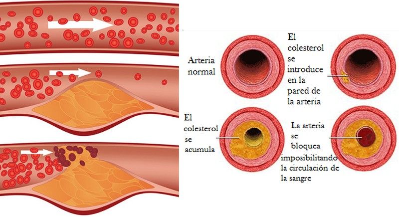 Combate el colesterol de forma natural LEVADURA ROJA DE ARROZ